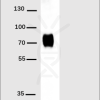 antibody-DME100001 His Fig1