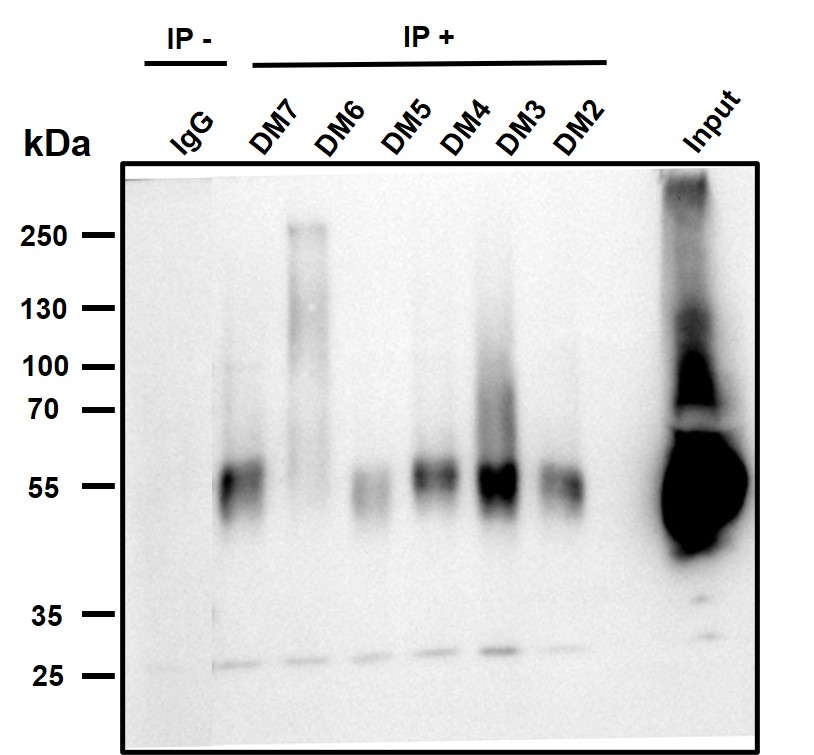 DME100004-BCMA-Fig6.jpg