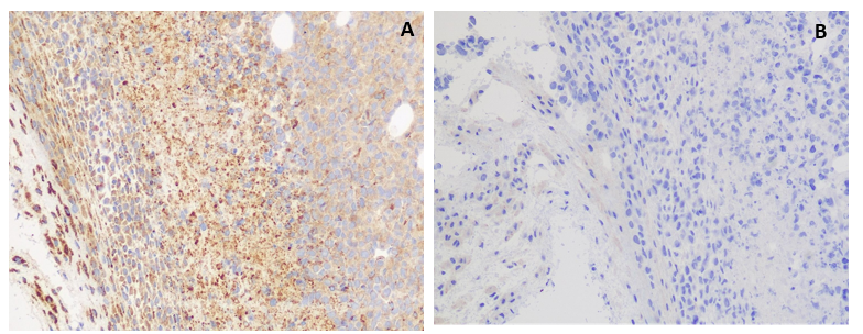 antibody-DME100061 GPRC5D Fig.5 IHC 1