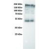 antibody-dmc100120 ceacam5 wb1