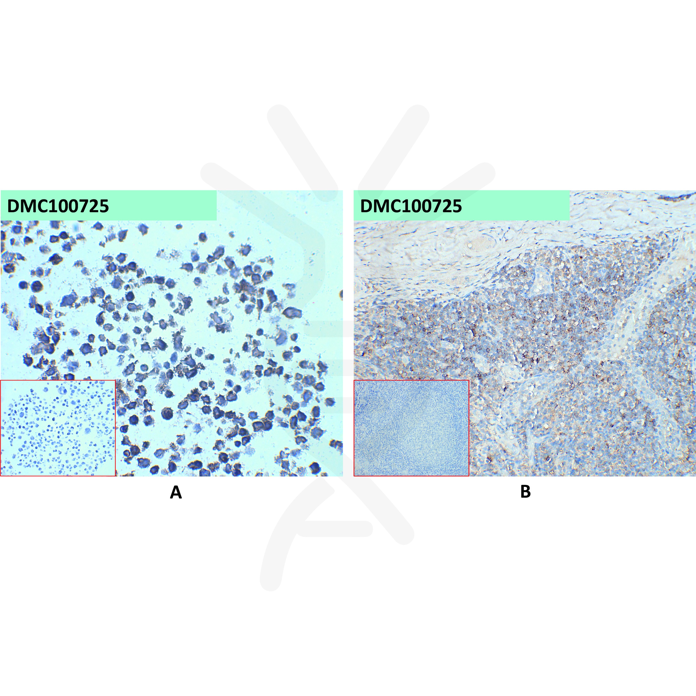 dmc100725-cd45-ihc1.jpg