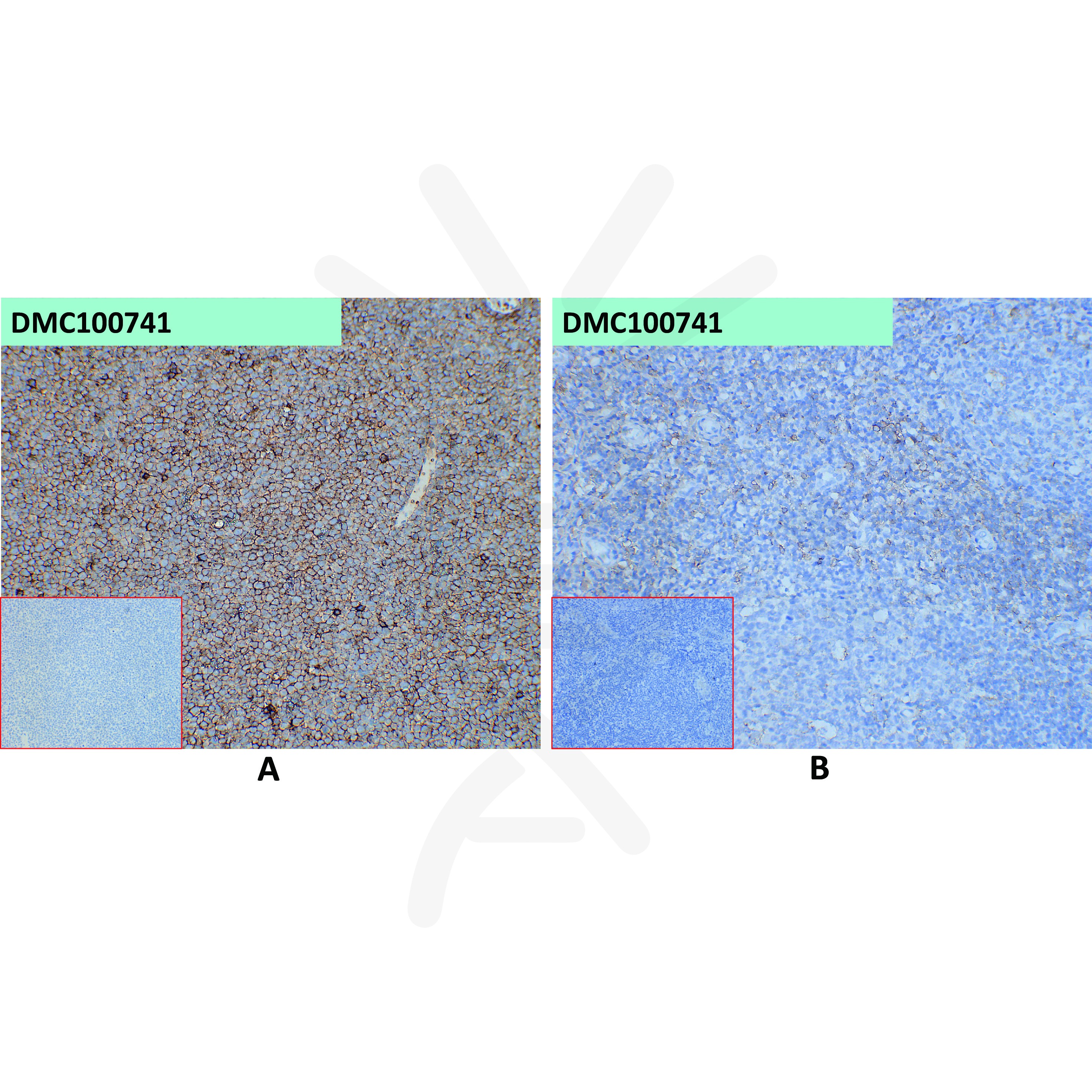 dmc100741-selplg-ihc1.jpg