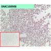 antibody-dmc100908 gpc3 ihc1
