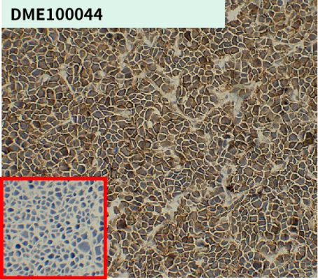 antibody-dme100044 cd138 ihc1