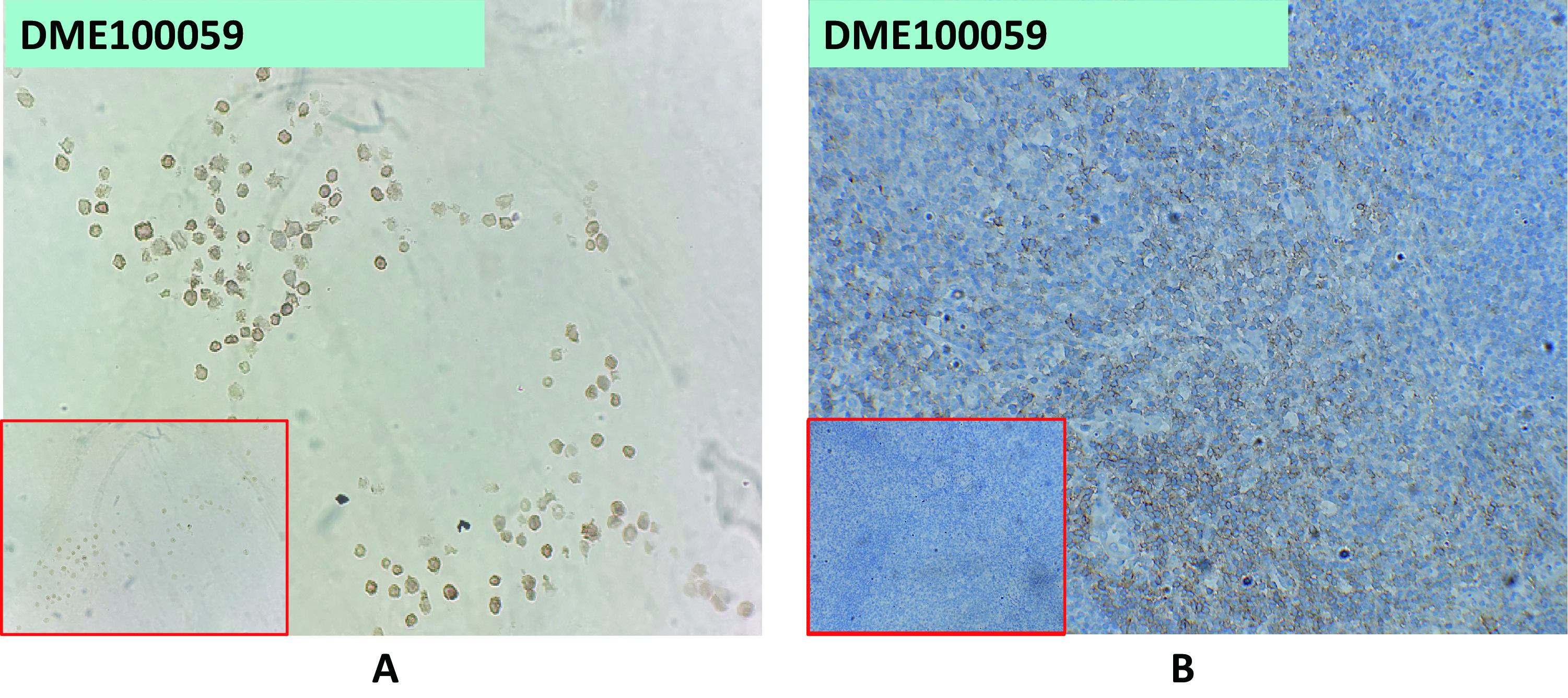 dme100059-cd27-ihc1.jpg