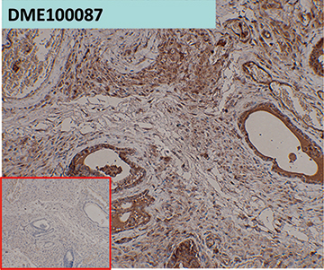 dme100087-psca-ihc1.jpg