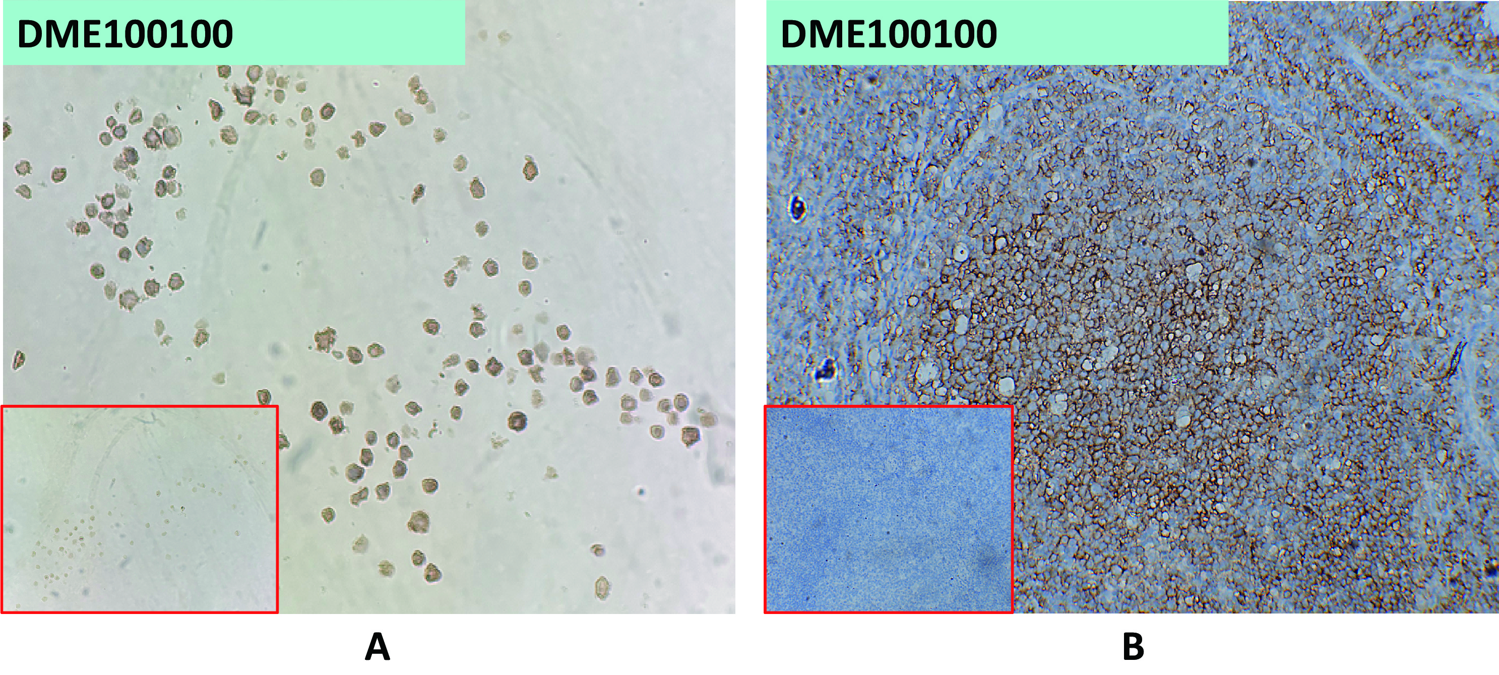 dme100100-cd40-ihc1.jpg