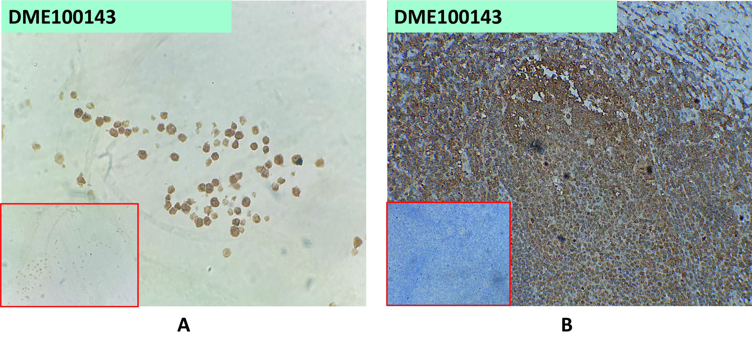 dme100143-baff-r-ihc1.jpg