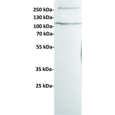 antibody-dme100433 her3 wb1