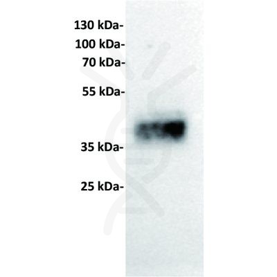 antibody-dme101001 trop2 wb1