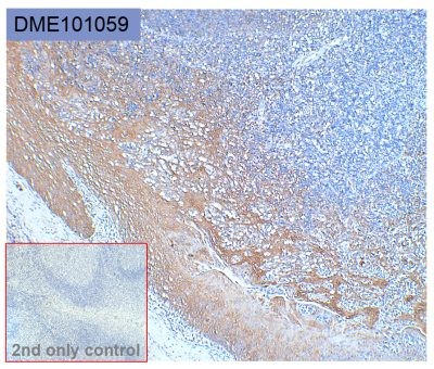 antibody-dme101059 her3 ihc1