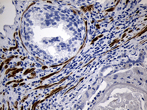 dme911453-spata46-ihc1.jpg