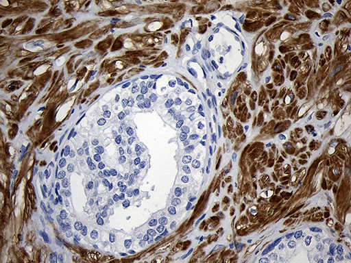 dme911453-spata46-ihc2.jpg