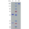 PAGE-bme100066 tgfb1 sp1
