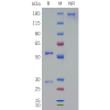 PAGE-bme100096 clu sp1
