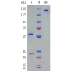PAGE-bme100144 il13 sp1