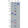 PAGE-bme100239 il18 sp1