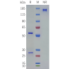 PAGE-bme100242 fgf23 sp1