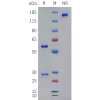 PAGE-bme100266 grem1 sp1