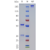 PAGE-bme100284 dna sp1