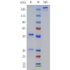 PAGE-bme100285 dna sp1
