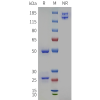 PAGE-bme100409 pcsk9 sp1
