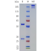 PAGE-bme100458 tfpi sp1