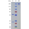 PAGE-bme100736 tgm2 sp1
