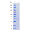 sp-cfp100011 ccr4 sp1