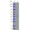 sp-cfp100021 drd2 sp1