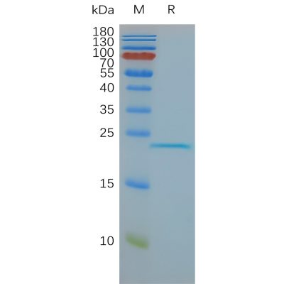 page-FLP100008 CLDN6 Fig.2 SDS PAGE 1