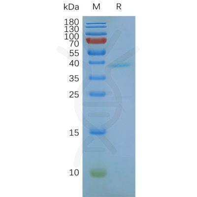 page-FLP100011 GPRC5D Fig.2 SDS PAGE 1