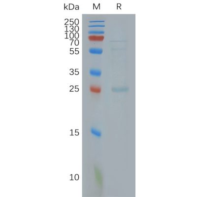 page-FLP100014 CLDN18.2 Fig.2 SDS PAGE 1