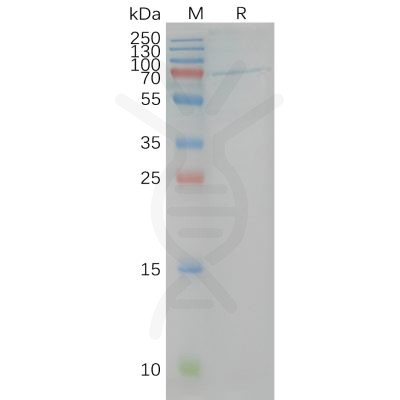 page-FLP100023 CB1 Fig.2 SDS PAGE 1