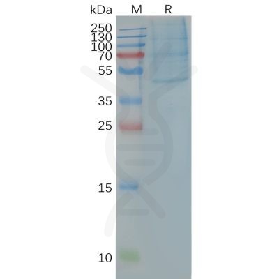 page-FLP100024 CCR4 Fig.2 SDS PAGE 1