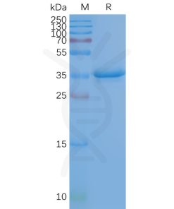 page-FLP100027 CD20 Fig.2 SDS PAGE 1