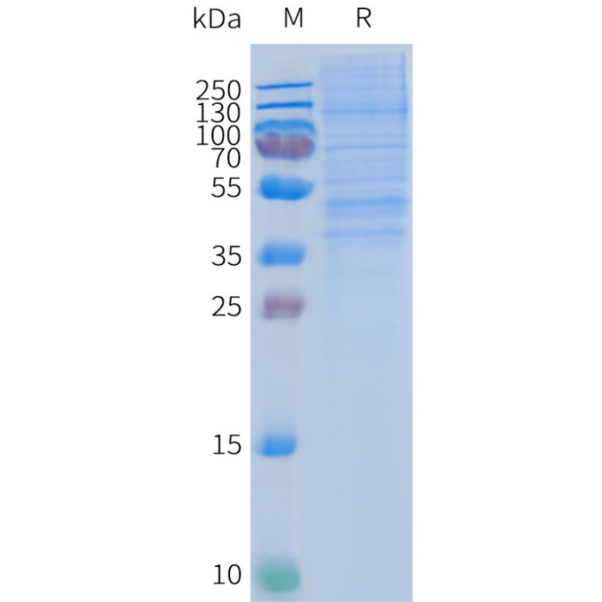 FLP100028-CCR2-Fig.2-SDS-PAGE-1.jpg