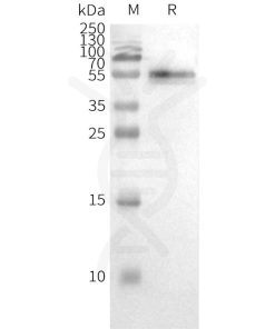 page-FLP100028 CCR2 Fig.3 SDS PAGE 2