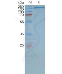 page-FLP100029 MDR 1 Fig.2 SDS PAGE 1