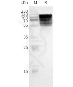 page-FLP100031 GPR75 Fig.2 SDS PAGE 1