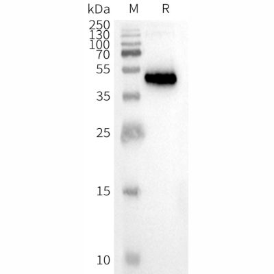 page-FLP100037 CCR8 Fig.2 SDS PAGE 1
