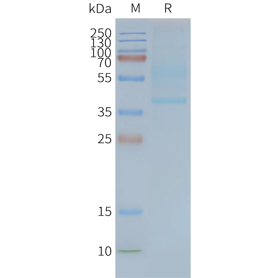 FLP100039-CD47-Fig.2-SDS-PAGE-1.jpg