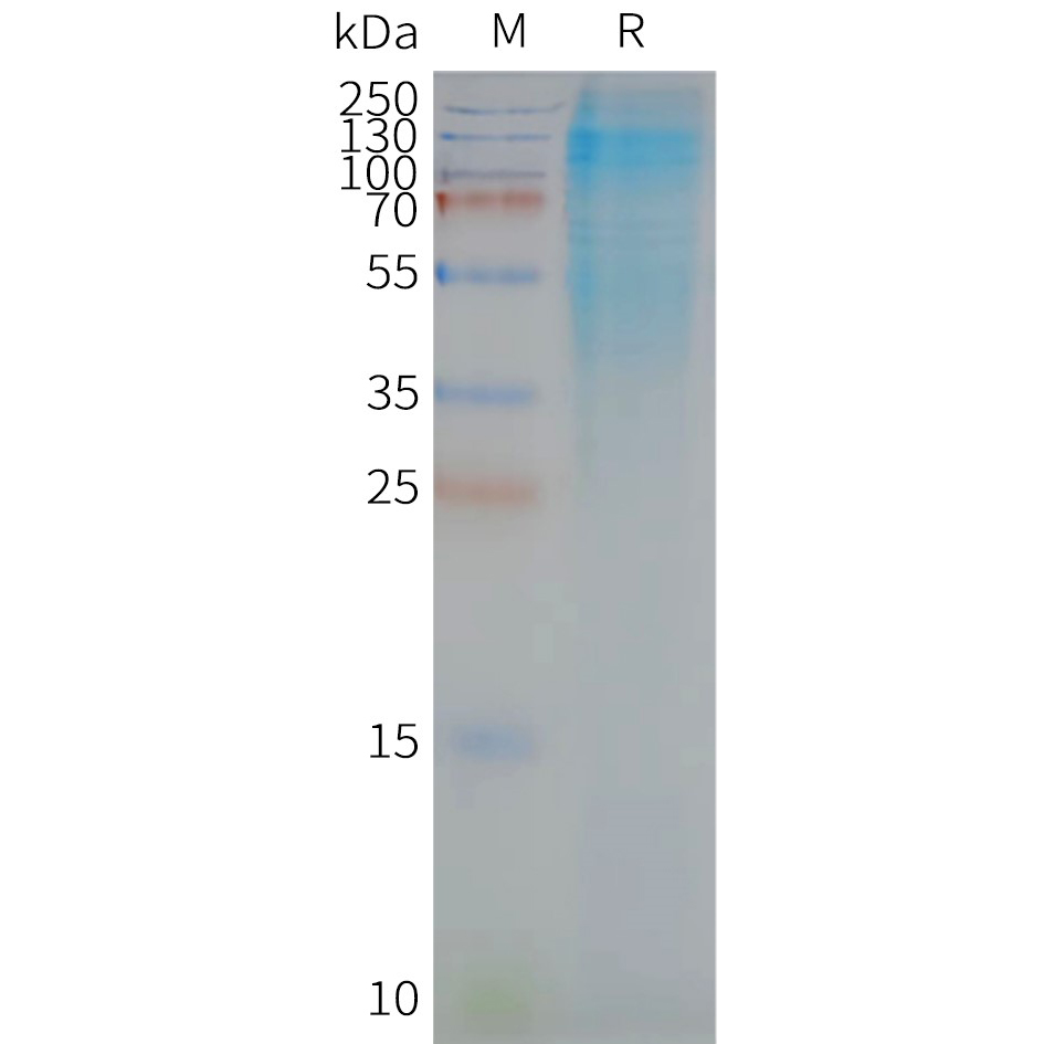 FLP100042-CD37-Fig.2-SDS-PAGE-1.jpg