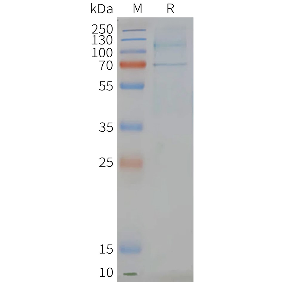 FLP100068-LGR6-Fig.2-SDS-PAGE-1.jpg