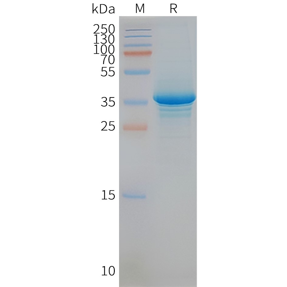 FLP100070-STEAP1-Fig.2-SDS-PAGE-1.jpg