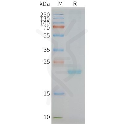 page-FLP100078 CLDN3 Fig.2 SDS PAGE 1