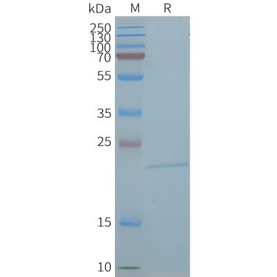 page-FLP100079 CLDN5 Fig.2 SDS PAGE 1