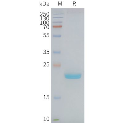 page-FLP100083 CLDN4 Fig.2 SDS PAGE 1