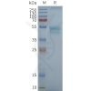 page-FLP100094 CCR1 Fig.2 SDS PAGE 1
