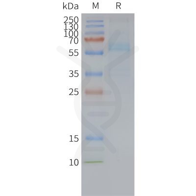 page-FLP100109 FZD7 Fig.2 SDS PAGE 1